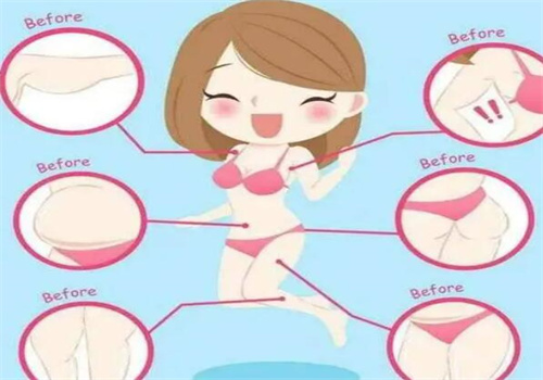 西安高一生抽脂好還是藝星好？醫(yī)生技術(shù)、價(jià)格差異與術(shù)后效果全解析