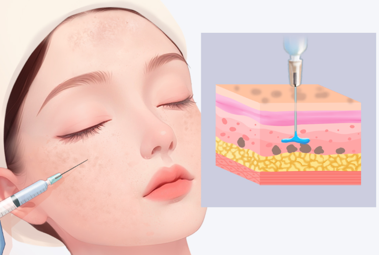 朱勝軍在武漢針劑界口碑怎樣