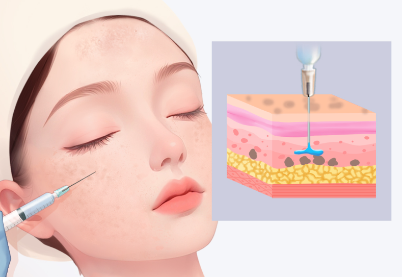 朱勝軍和張琦注射技術(shù)特點對比