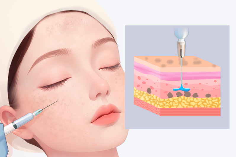 武漢藝星朱勝軍技術(shù)實(shí)力怎么樣