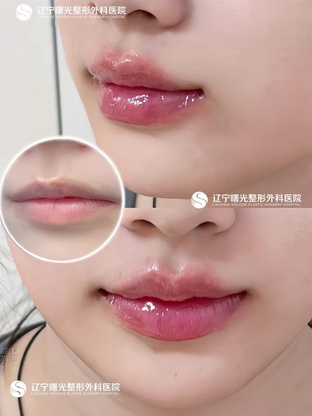 肖瀟醫(yī)生經(jīng)驗多www.66ub.cn