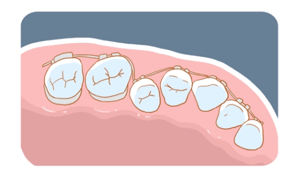 三、正畸每次都需要同一個醫(yī)生嗎？必須更換醫(yī)生的情況有哪些