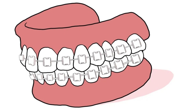 二、正畸每次都需要同一個醫(yī)生嗎？更換醫(yī)生的風(fēng)險與挑戰(zhàn)