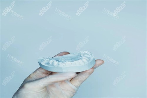 牙齒矯正模型展示 牙齒矯正模型展示