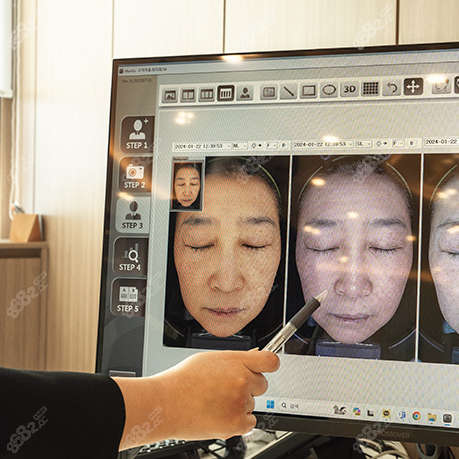 Reberry皮膚檢測(cè) Reberry皮膚檢測(cè)