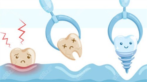 拔牙過程圖 拔牙過程圖