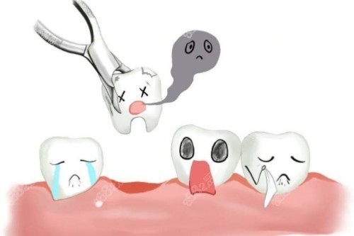 拔牙卡通展示圖 拔牙卡通展示圖