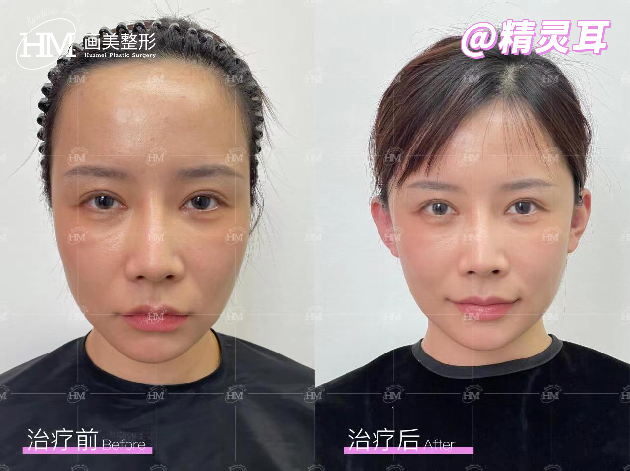 亓敏醫(yī)生技術(shù)不錯