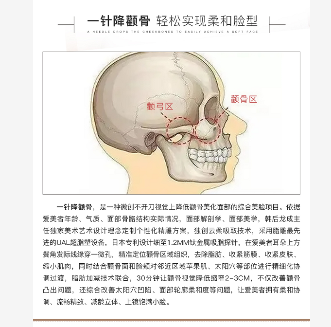 張笑天顴骨手術(shù)費用情況