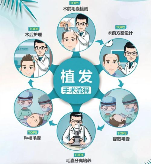 合肥植發(fā)去哪里做比較靠譜