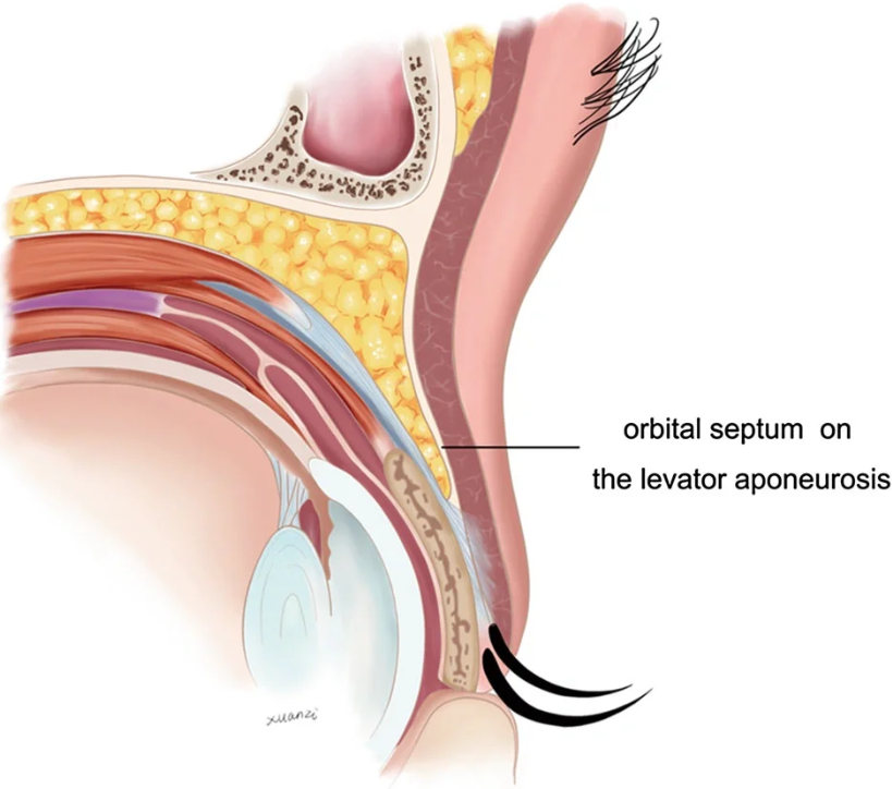 鄭州孟明星醫(yī)生雙眼皮修復(fù)案例