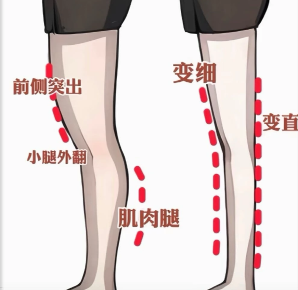 選擇大小腿吸脂醫(yī)生時(shí)的價(jià)格與價(jià)值平衡