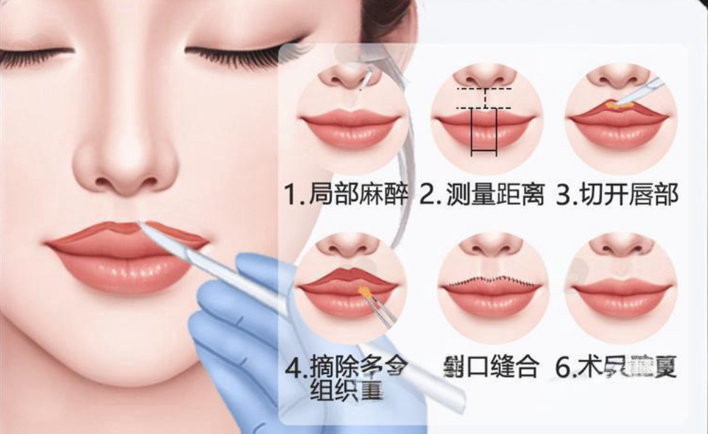 上海張賀醫(yī)生人中縮短手術(shù)預(yù)約掛號(hào)