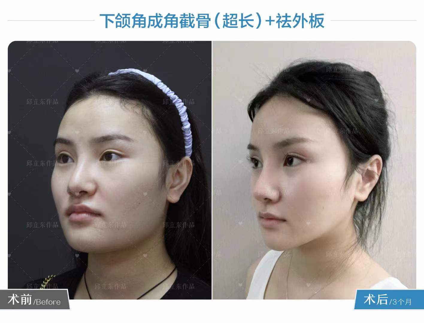 北京圣嘉新醫(yī)療美容醫(yī)院邱立東醫(yī)生口碑評價如何？