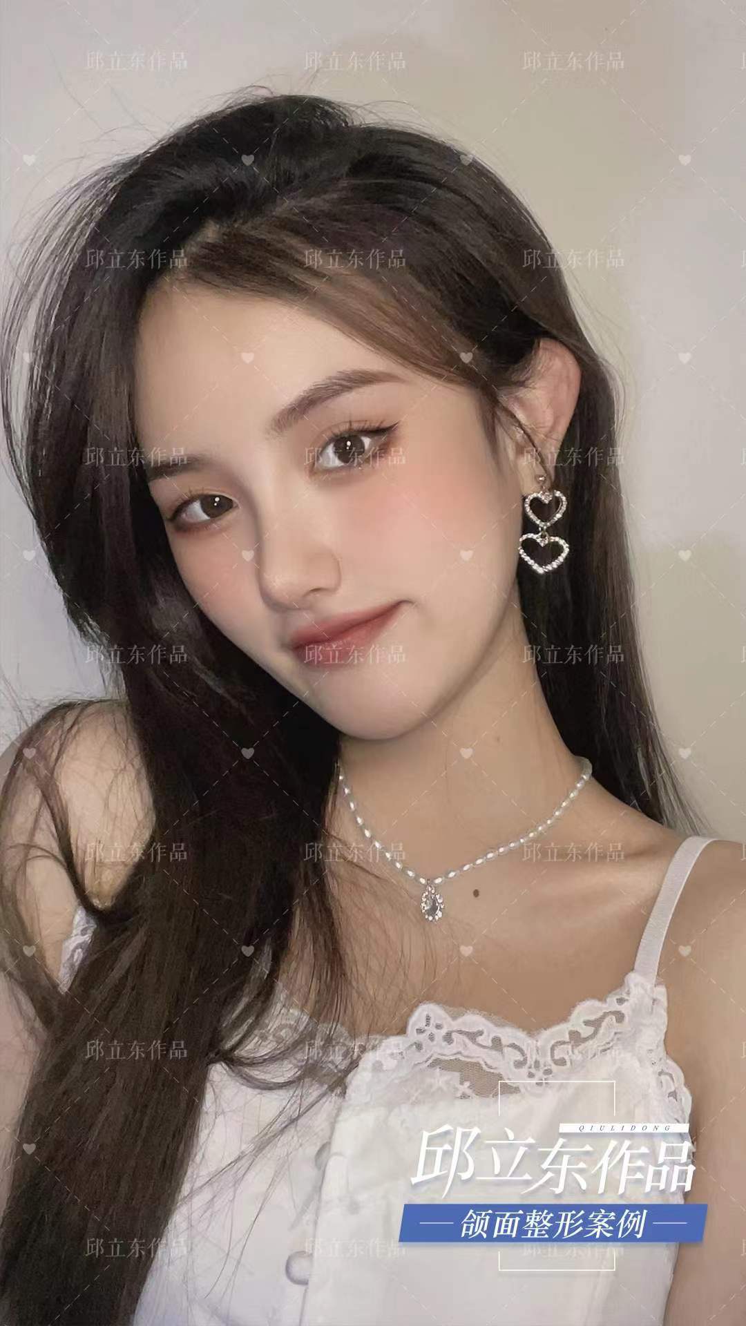 北京圣嘉新醫(yī)療美容醫(yī)院邱立東醫(yī)生掛號預(yù)約攻略www.66ub.cn