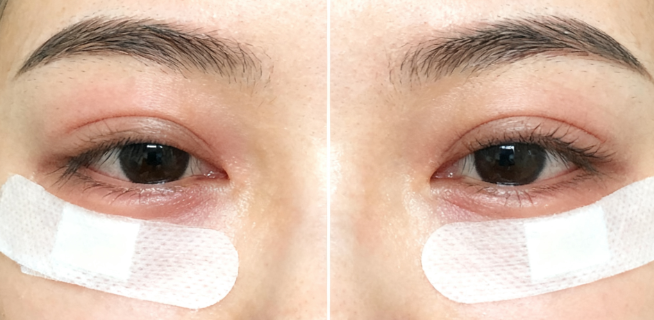 三、王維雙眼皮多少錢www.66ub.cn