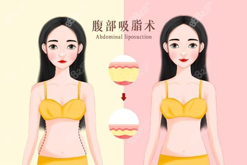 福州吸脂比較出名的醫(yī)生名單