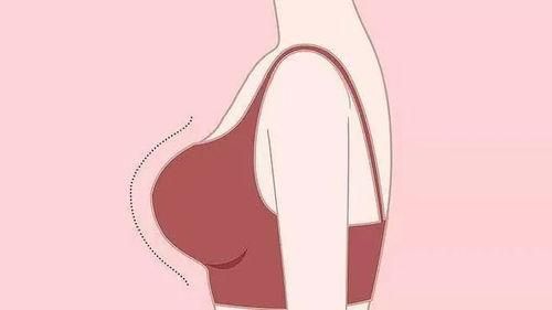 佐蘭雅iba極速豐胸要躺多久