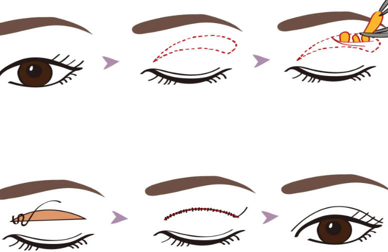 長(zhǎng)春圣顏醫(yī)療美容的項(xiàng)目與價(jià)格