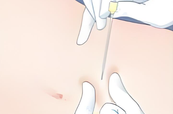 福州埋線減肥醫(yī)院掛什么科？特色科室