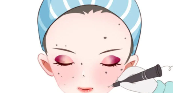 南昌點痣去哪家醫(yī)院哪里好www.sorencai.cn