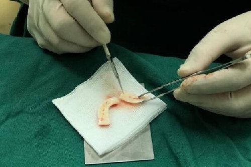 上海徐永豐隆鼻價(jià)位多少