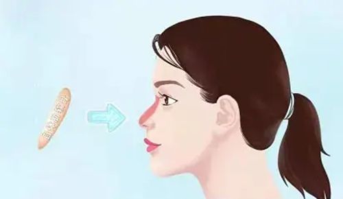 想找徐永豐做鼻綜合