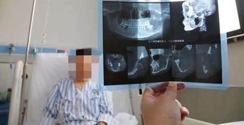 柳超醫(yī)生背景解析