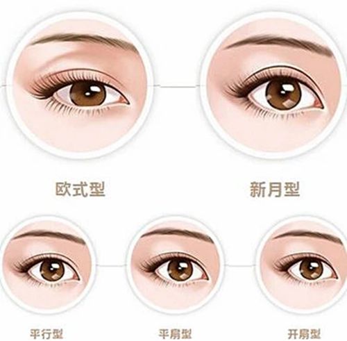 馬天華雙眼皮失敗修復怎么樣