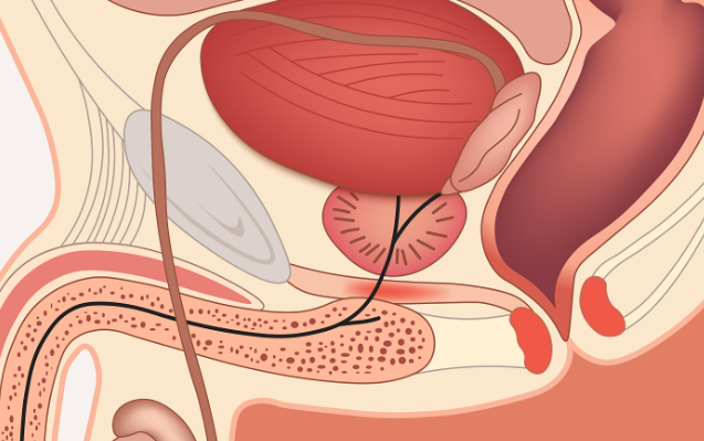 朔州曙光男科醫(yī)院可靠的表現(xiàn)