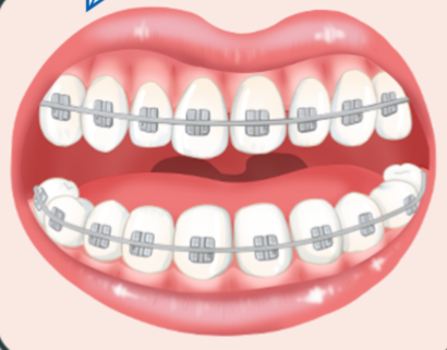 甘肅省口腔醫(yī)生哪個(gè)好？劉淑祁濤這10位口碑醫(yī)生讓你告別口腔煩惱！