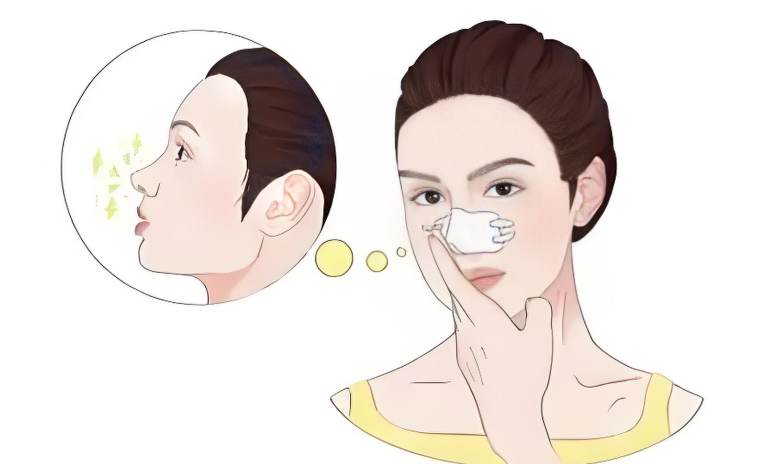 高順福醫(yī)生做鼻子為什么取雙側(cè)耳軟骨