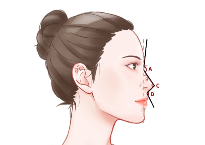 高順福醫(yī)生雙側(cè)耳軟骨隆鼻收費