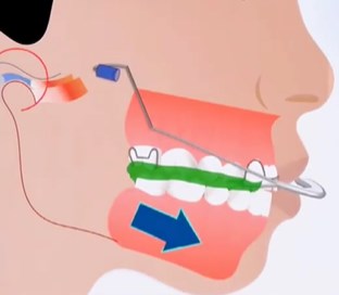 一、李向東正畸醫(yī)生的專門資質(zhì)與臨床經(jīng)驗