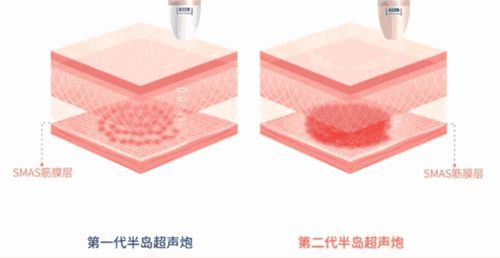 四、韓國(guó)黃金微針全臉價(jià)格避坑&預(yù)約攻略：別花冤枉錢(qián)