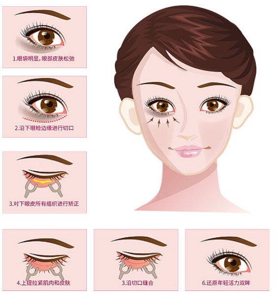 總結(jié)www.66ub.cn