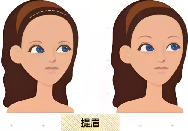 眼袋問(wèn)題困擾著許多愛(ài)美人士