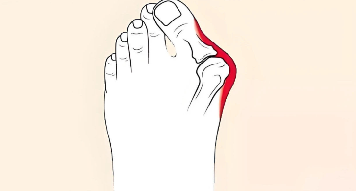 北京大腳骨矯正手術(shù)醫(yī)生測(cè)評(píng)對(duì)比：蘇敬達(dá)vs馬桂文vs溫建民，技術(shù)細(xì)節(jié)差在哪一看就懂