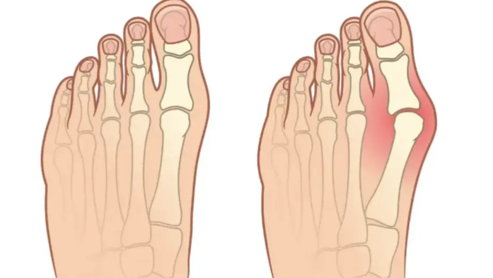 為直觀對(duì)比，整理北京大腳骨矯正手術(shù)醫(yī)生測(cè)核心信息表格如下：www.66ub.cn