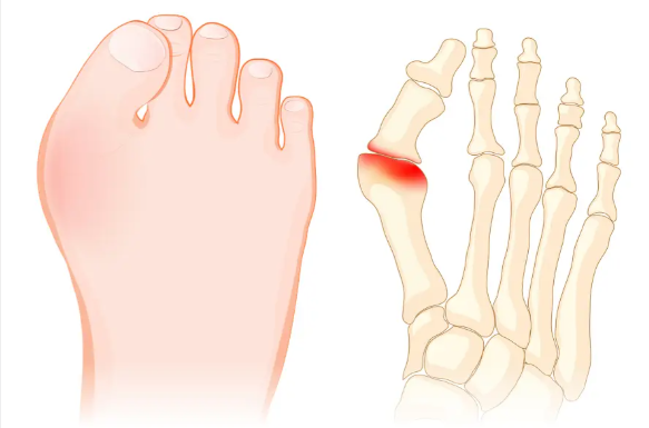 北京大腳骨矯正手術(shù)醫(yī)生測(cè)評(píng)重點(diǎn)關(guān)注維度