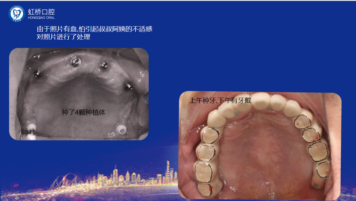 三、無錫北極星口腔的其他口腔項目價格