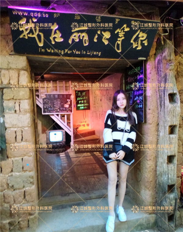 六、馮斌吸脂20萬親身經(jīng)歷：術前準備與術后護理全指南