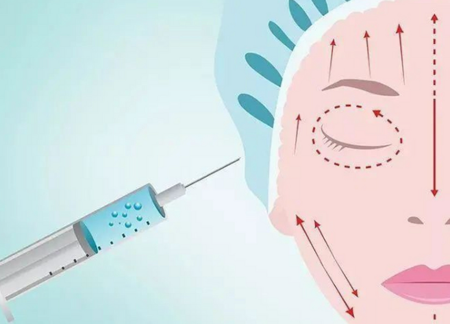 艾塑菲的特點與修復(fù)需求