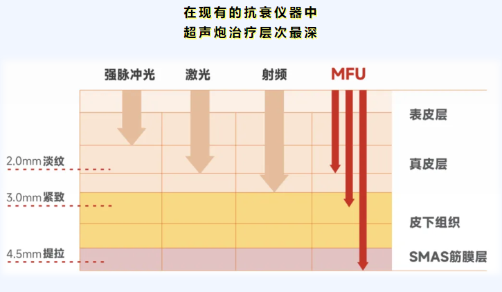 四、哪些人適合半島超聲炮，哪些人適合鉆石超聲炮？