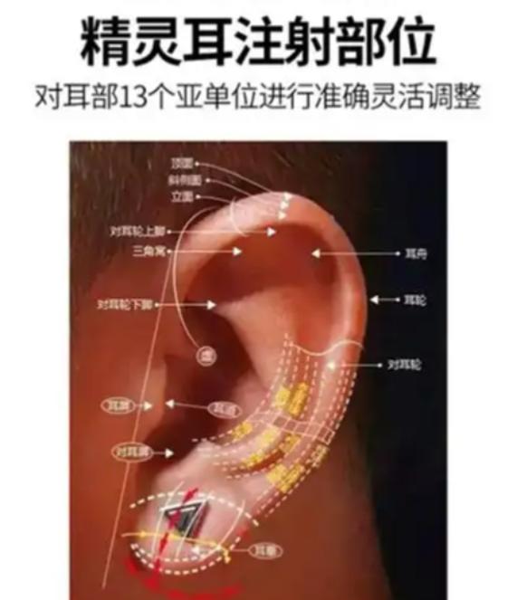 三、杭州玻尿酸精靈耳注射價(jià)格參考