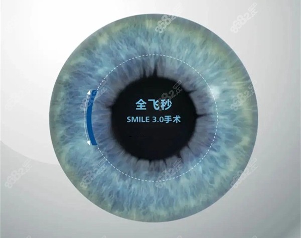 大連愛爾眼科和何氏眼科哪個好 大連愛爾眼科和何氏眼科哪個好