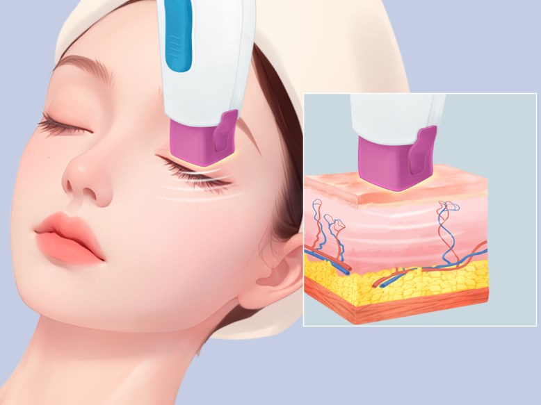 南京淚溝填充哪家好