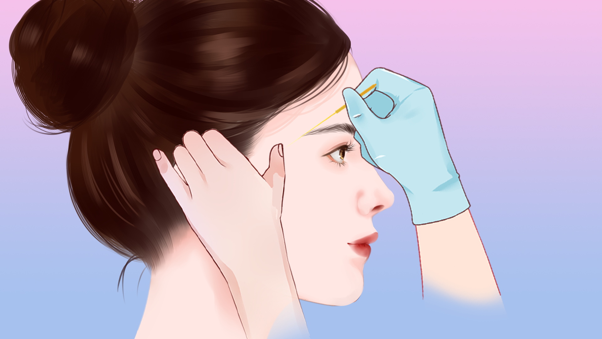 藏不住了！南京藝星整形比較有名的注射醫(yī)生：王薇骨膜上打法 + 李哲液態(tài)提拉+ 張明遠(yuǎn)肌電定位，怎么選？