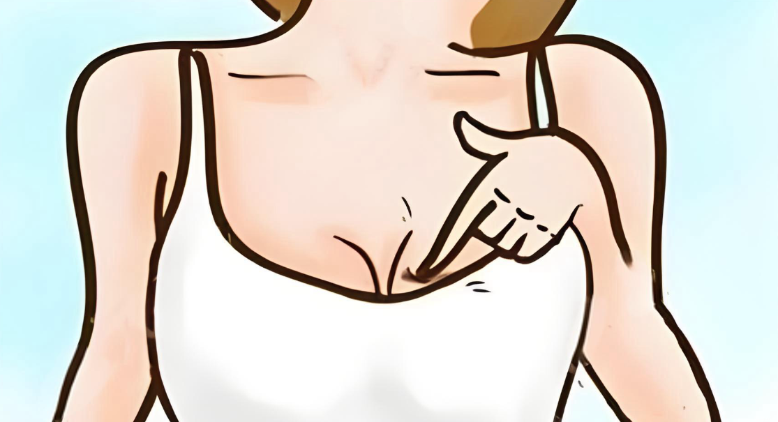 胸下垂6厘米外擴(kuò)5厘米嚴(yán)重嘛怎么救?手術(shù)懸吊 + 假體移植