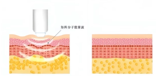 韓國PFK項目詳情